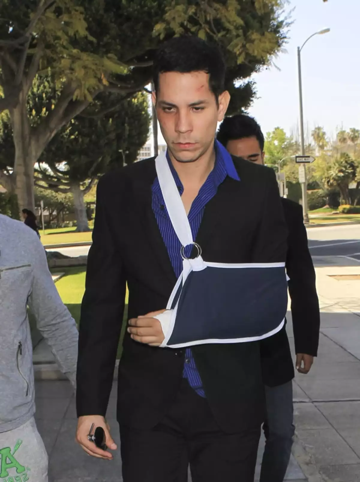 El ex RBD fue captado en Beverly Hills, su apariencia indica que él quedó peor que Benjamin Stewart-Kruger. El cantante manifestó su dolor, tanto físico como psicológico tras el incidente.