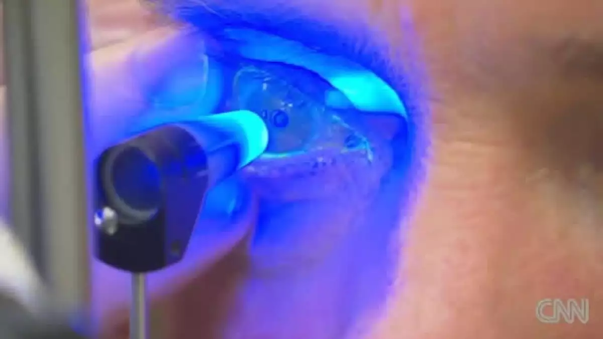ojo
