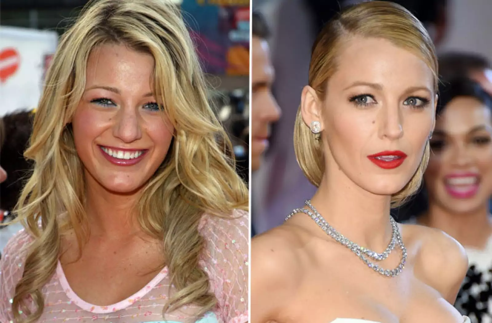 Blake Lively luce hoy un rostro casi perfecto, sin embargo, antes era notorio que tenía una nariz un poco más ancha.