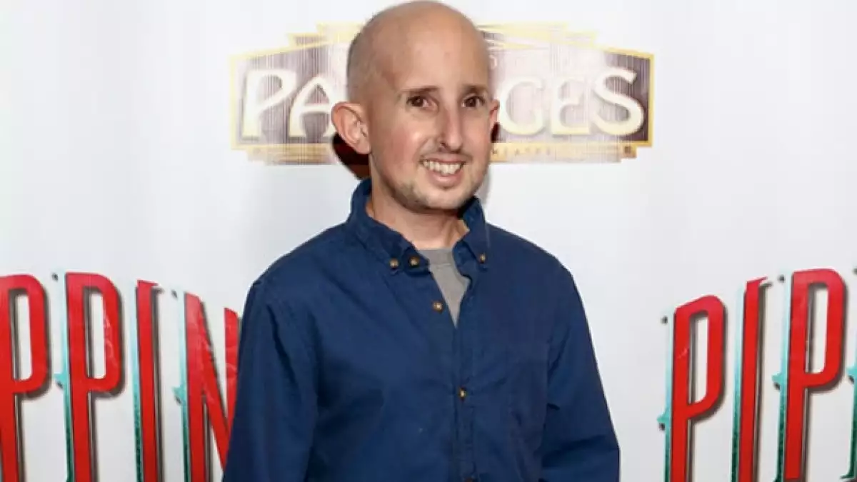 El actor padecía padecía enanismo hipofisario