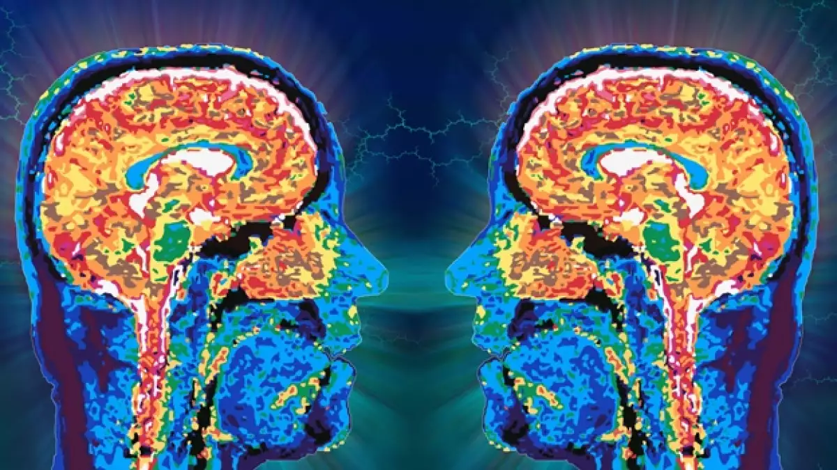 cerebro