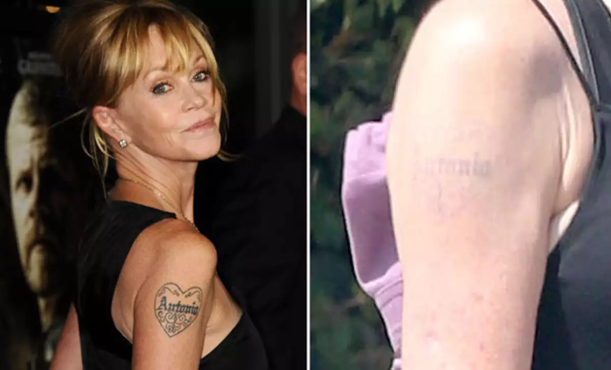 Melanie Griffith se tatuó en honor a Antonio Banderas, y a un año de su separación, hizo que le removieran el tatuaje.