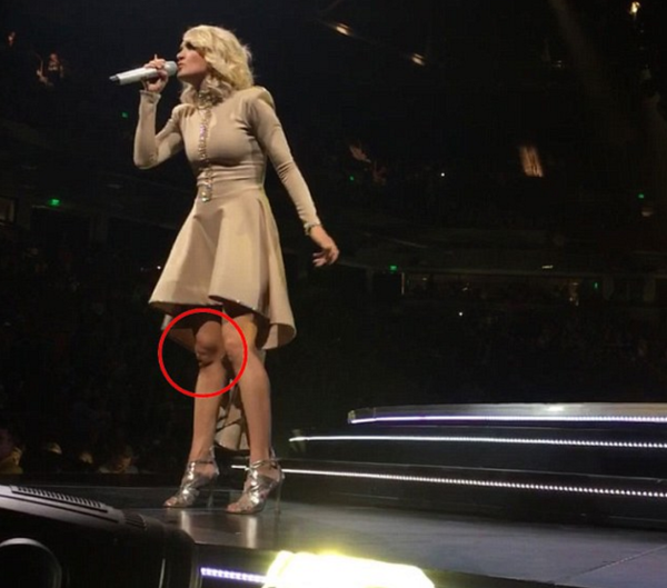 Rodilla Carriw Underwood + príncipe George