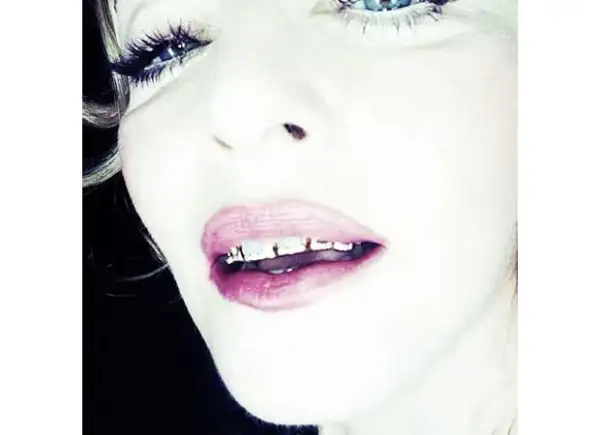 Las parrillas dentales de Madonna son de 24 diamantes.