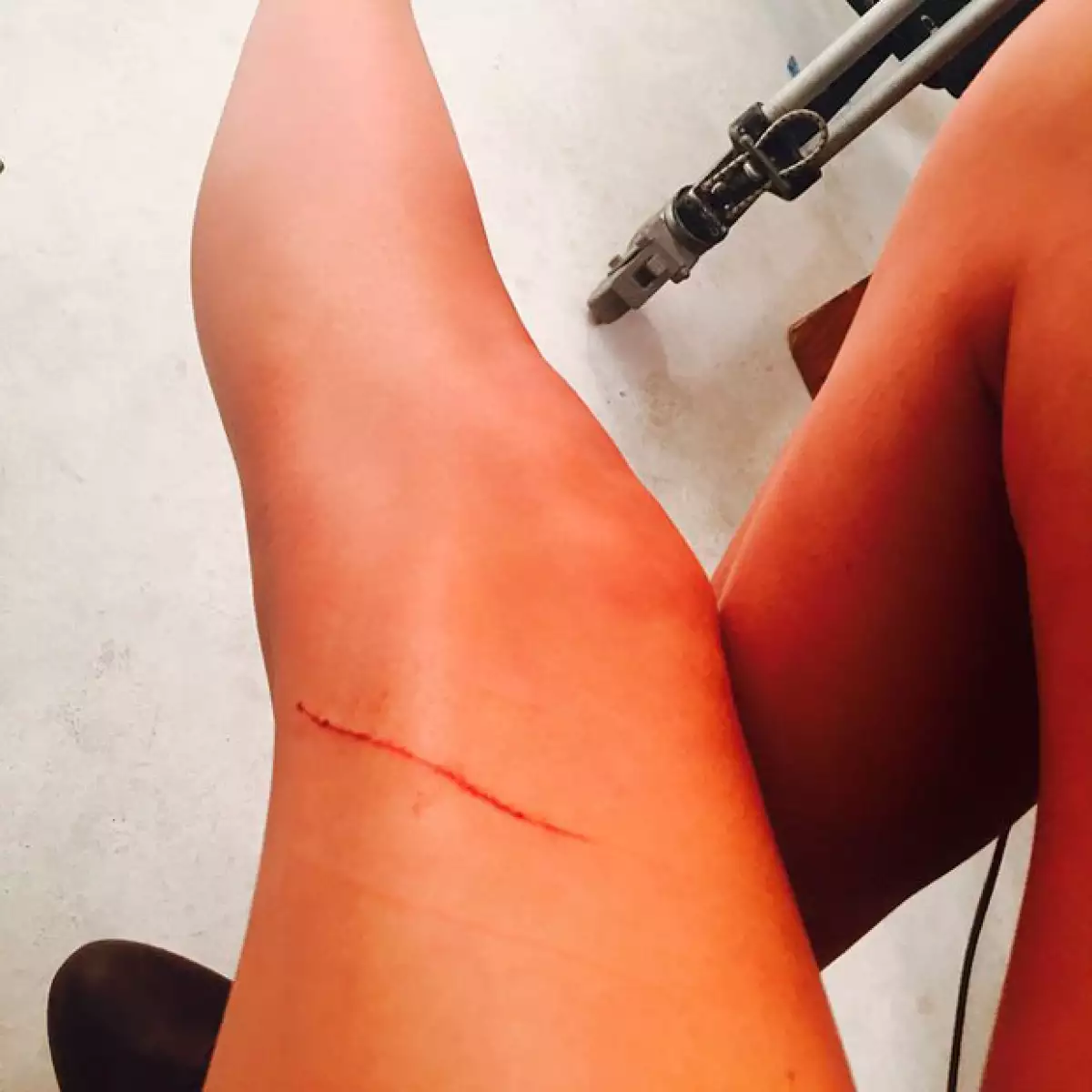 Taylor sufrió una primer herida en sus valiosísimas piernas a días de haberlas asegurado.