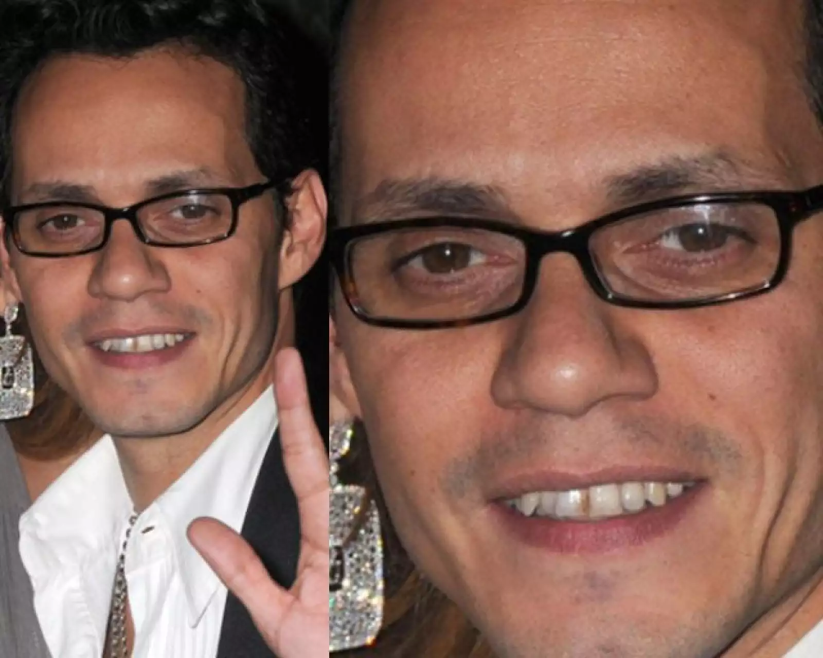 Marc Anthony parece no saber lo que es un dentista, pues tiene los dientes chuecos, amarillentos y hasta con manchas.