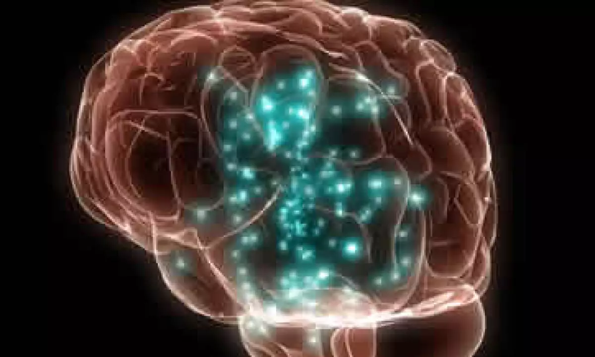 Tener un mapeo cerebral, a través del cual la persona identifique sus capacidades naturales, puede ayudar a elegir carrera, definir una trayectoria profesional, e incluso, ver en qué áreas es posible trabajar para tener un mejor desempeño laboral. (Foto: