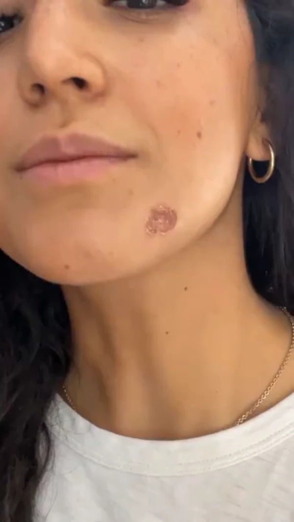 ale-herida.jpg