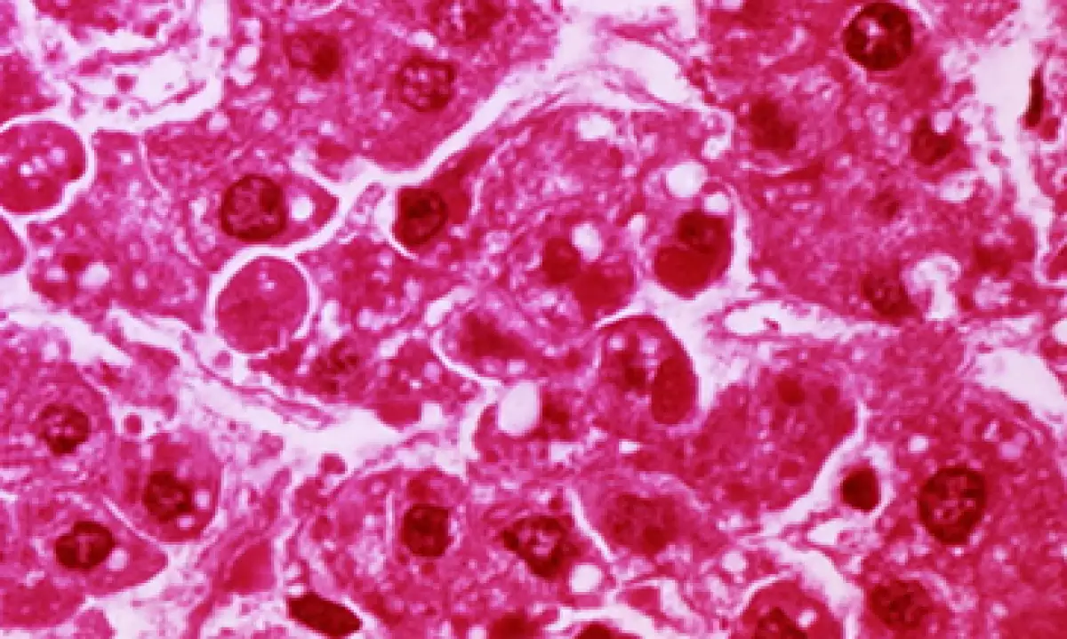El sistema permite observar el proceso de nutrición de las células. (Foto: Getty Images)