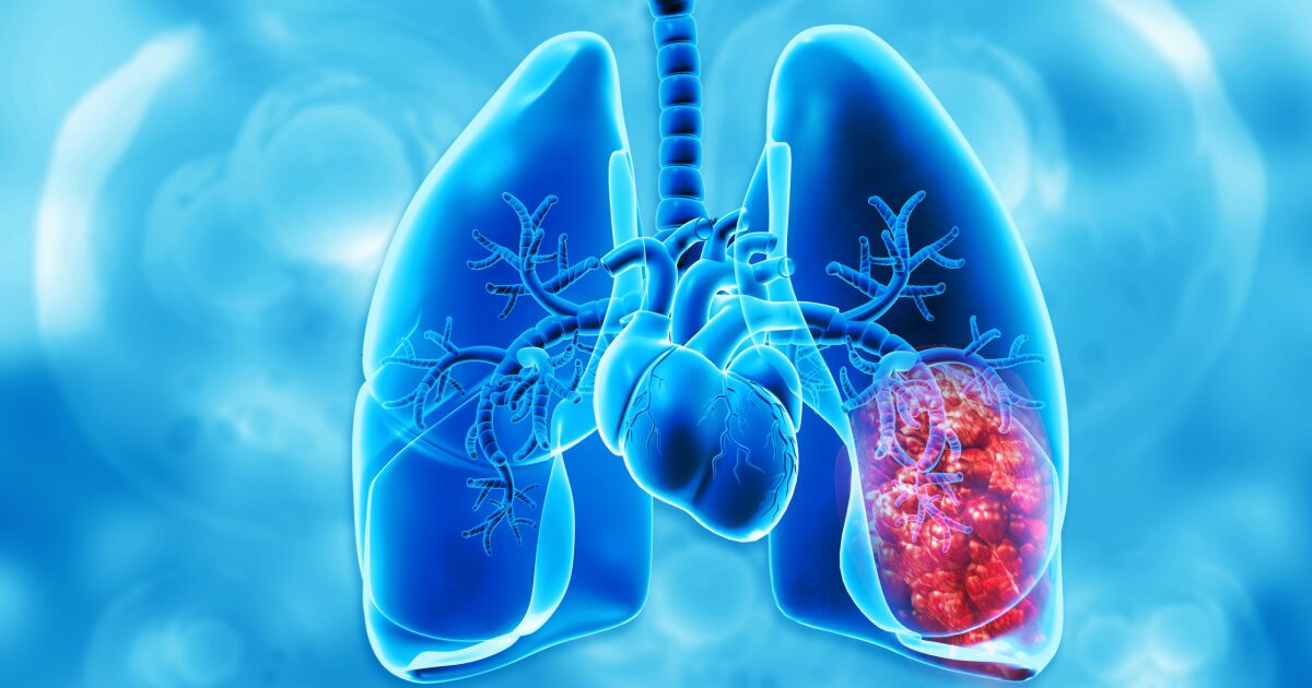 Tromboz nedir ve bu hastalık hangi semptomlara neden olur?