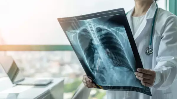 Doctor diagnosing patientâs health on asthma, lung disease, COVID-19 or bone cancer illness with radiological chest x-ray film for medical healthcare hospital service