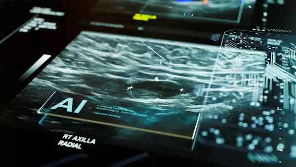 La Inteligencia Artificial se suma a la lucha contra el cáncer