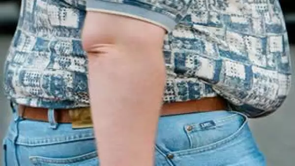 obesidad_gordo
