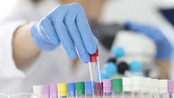 Unas muestras de laboratorio son acomodadas por personal de salud. Laboratorio Médico Polanco.