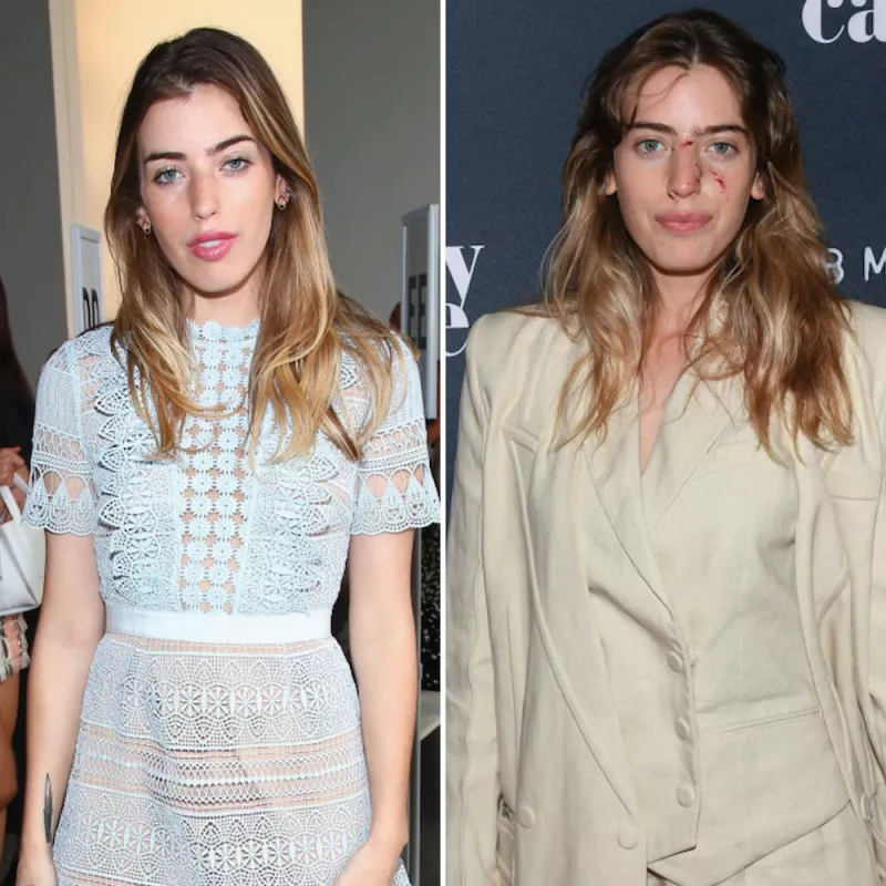 clara-antes-despues.jpg