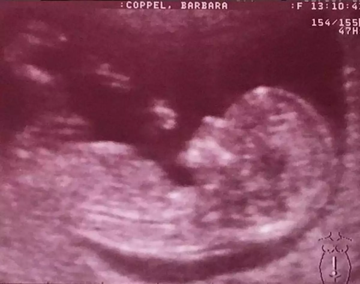 Esta es la primera foto del ultrasonido que compartió Bárbara en sus redes sociales.