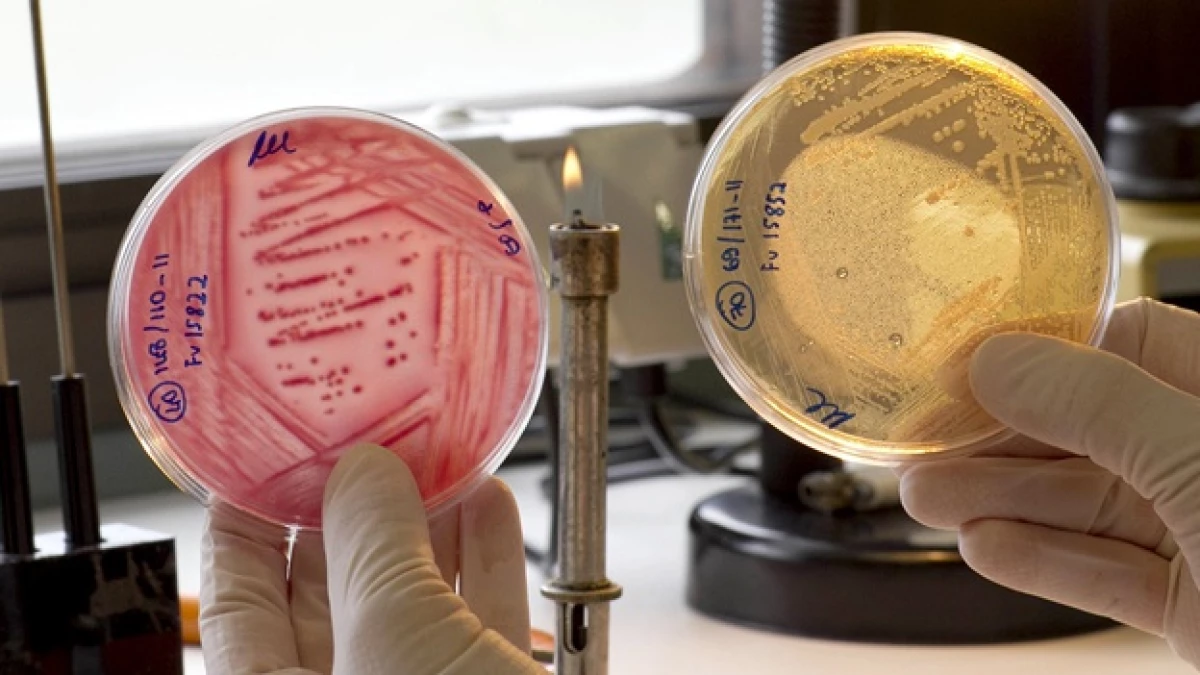 pruebas de laboratoria del e. coli