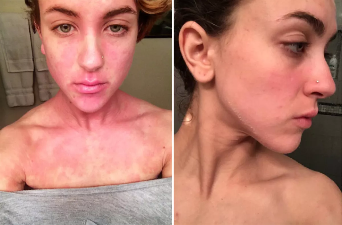 En la foto de la izquierda, Ciena hace dos años, publicó esta foto para decir que es de las peores veces en las que ha estado; la foto de la derecha la compartió hace unos días.