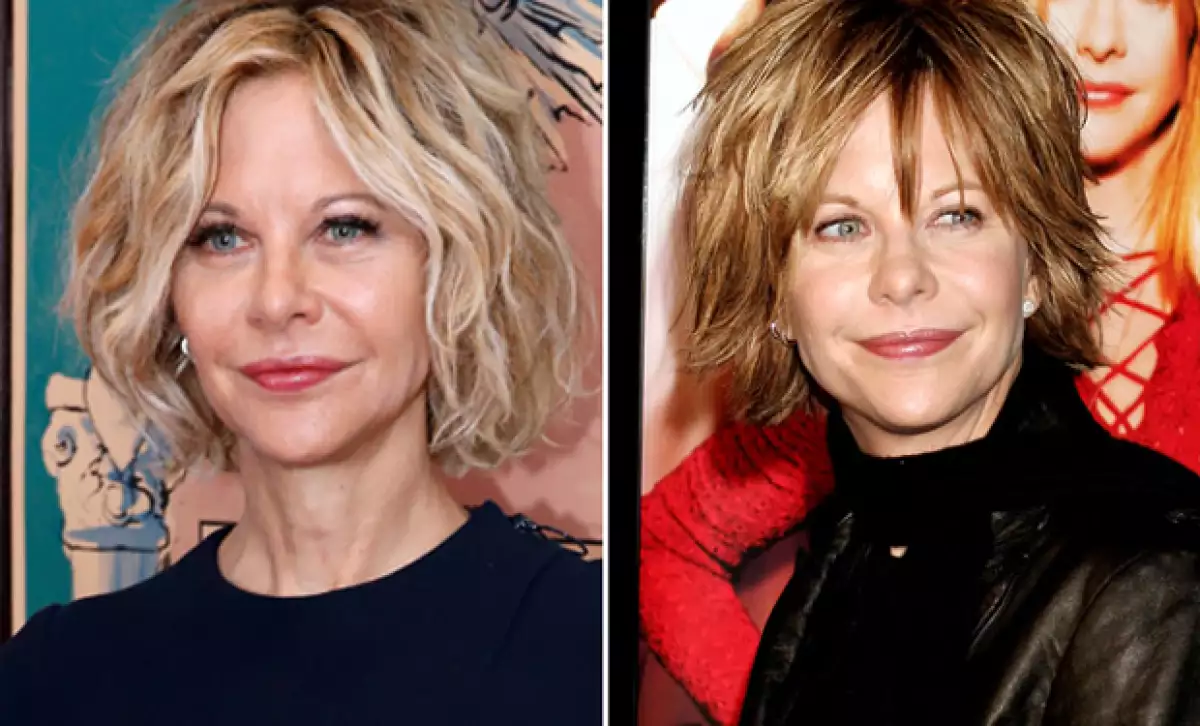 Durante los años, la actriz ha ido cambiando, pues desde siempre expresó su gusto por las cirugías plásticas.