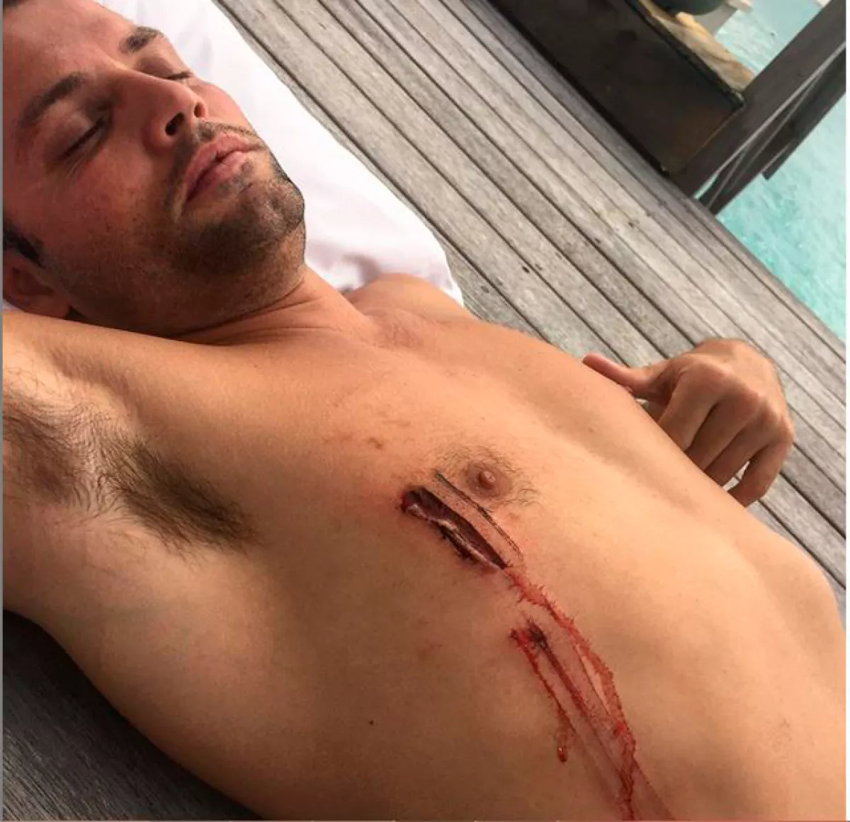 Uno de los amigos del cantante resultó herido por un tiburón.
