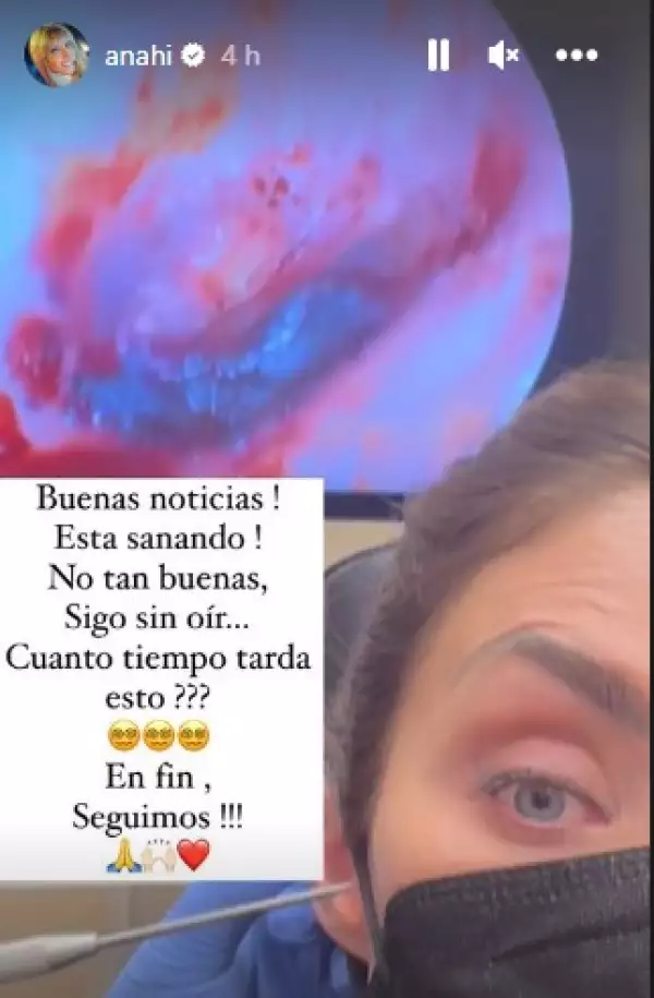 anahi-oido.jpg