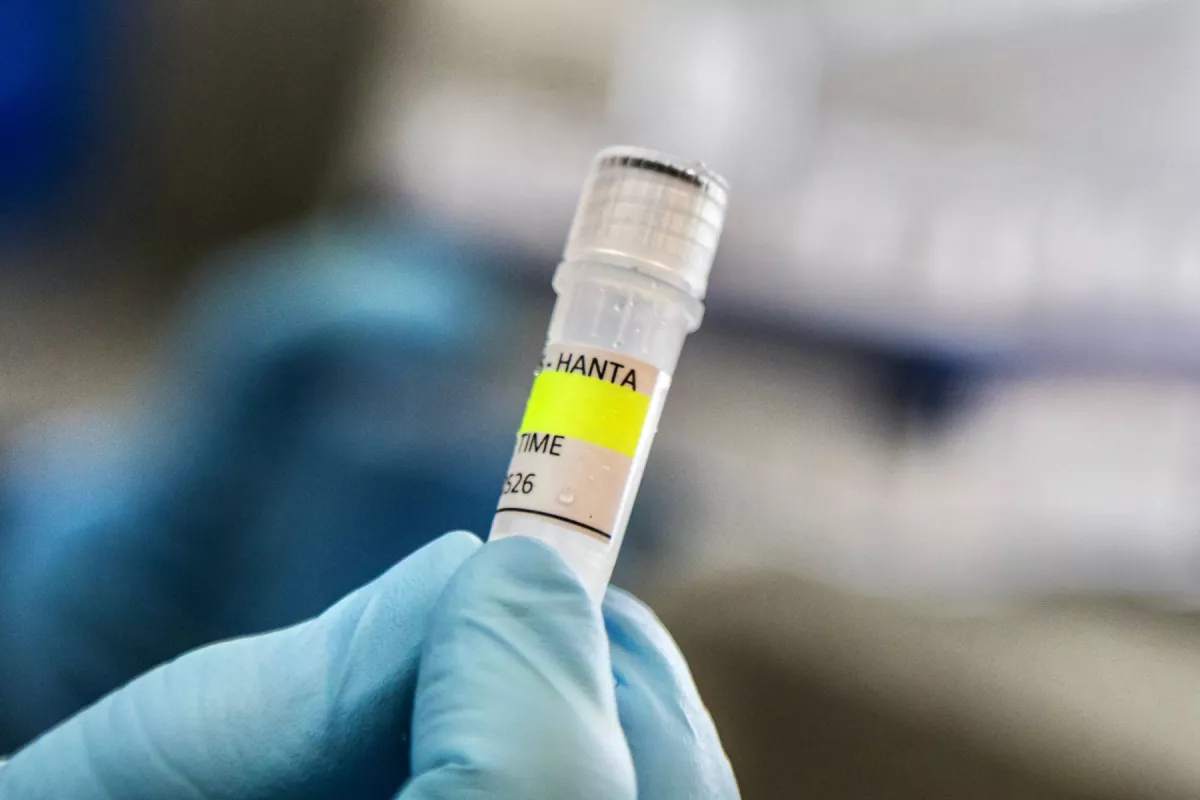 Este folleto publicado por el Ministerio de Salud de Argentina muestra a un científico del Instituto Malbr·n sosteniendo un contenedor utilizado para diagnosticar el hantavirus de los Andes, que contiene ARN del virus de los Andes como parte del proceso de detección, en Buenos Aires el 6 de mayo de 2026. Argentina ha visto un aumento en los casos de hantavirus, pero no un brote, dijo un experto a la AFP el 6 de mayo, ya que las infecciones a bordo de un crucero han provocado un susto de salud mundial.