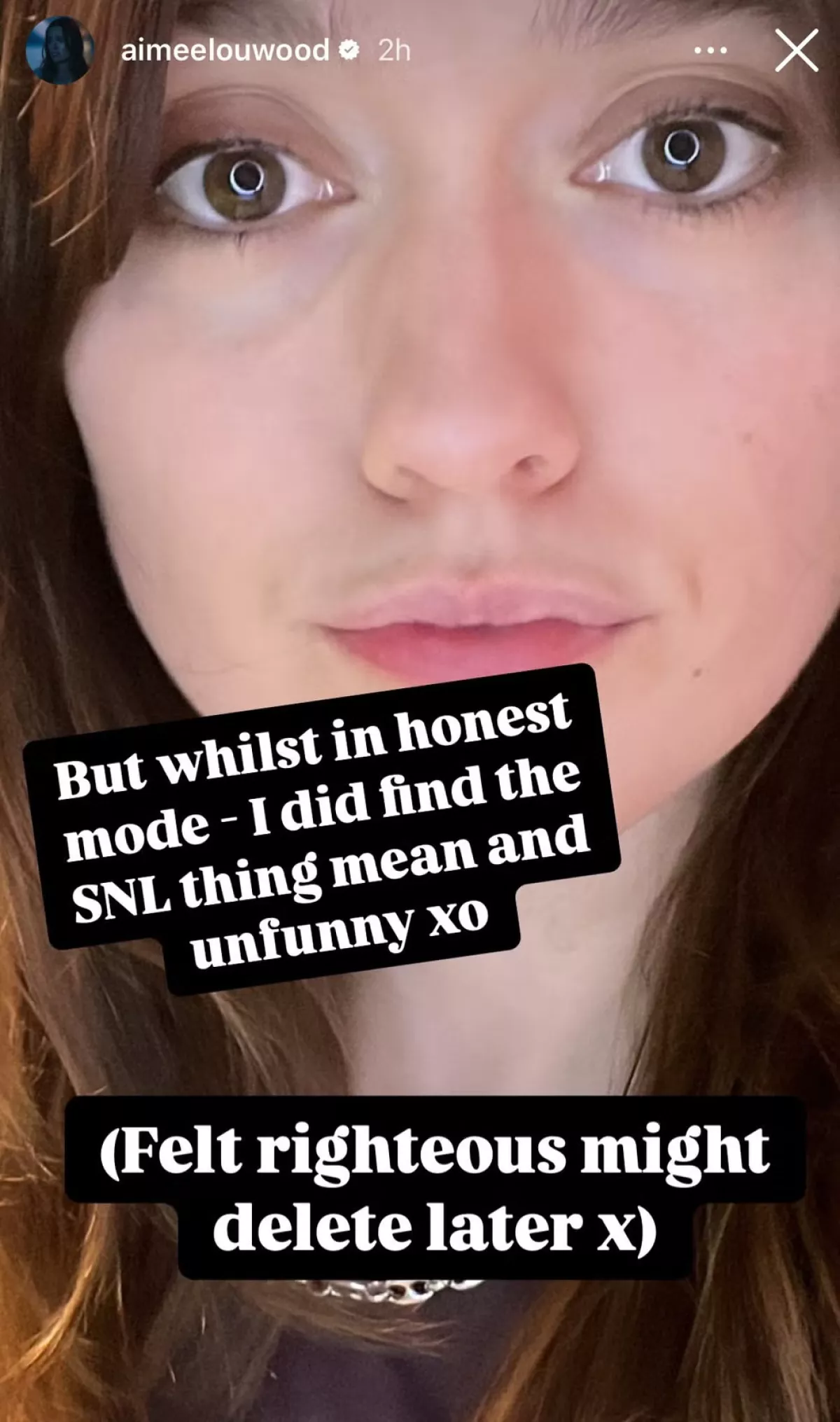 aimee-lou-wood-dientes-snl