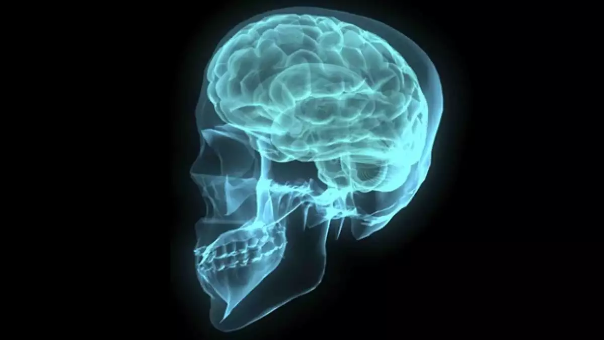 cerebro