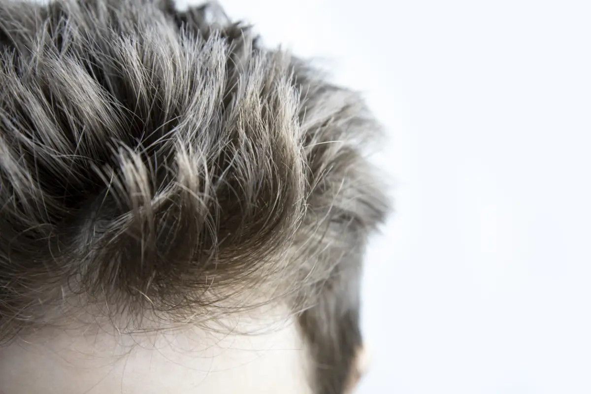 Male head with lush erect hair.