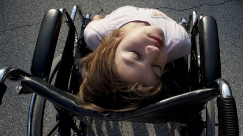 arthrogryposis