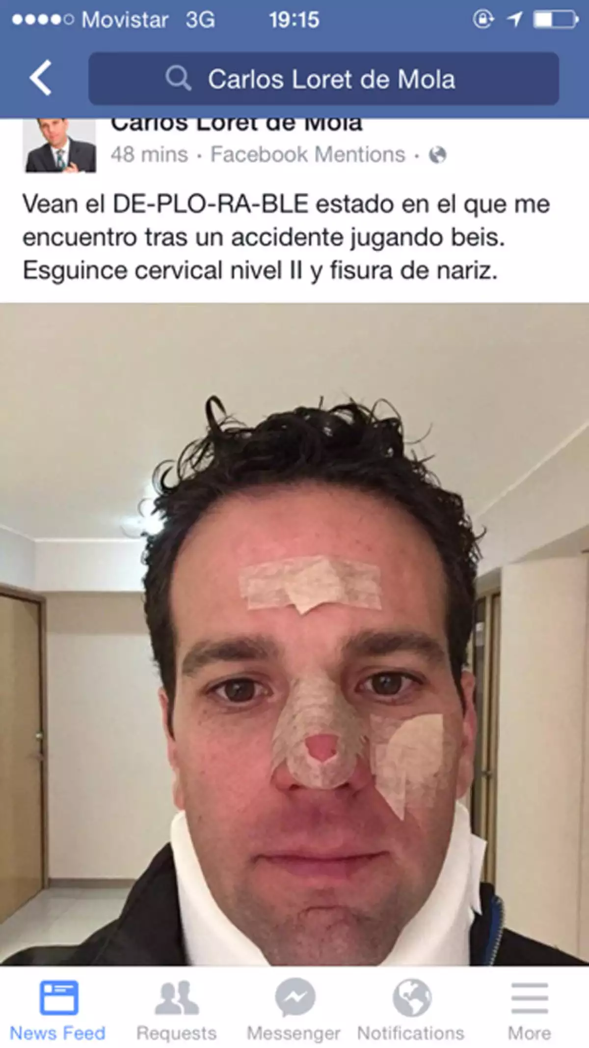 El periodista tuvo un accidente al practicar este deporte, rompiéndose la nariz y sufriendo un esguince cervical.
