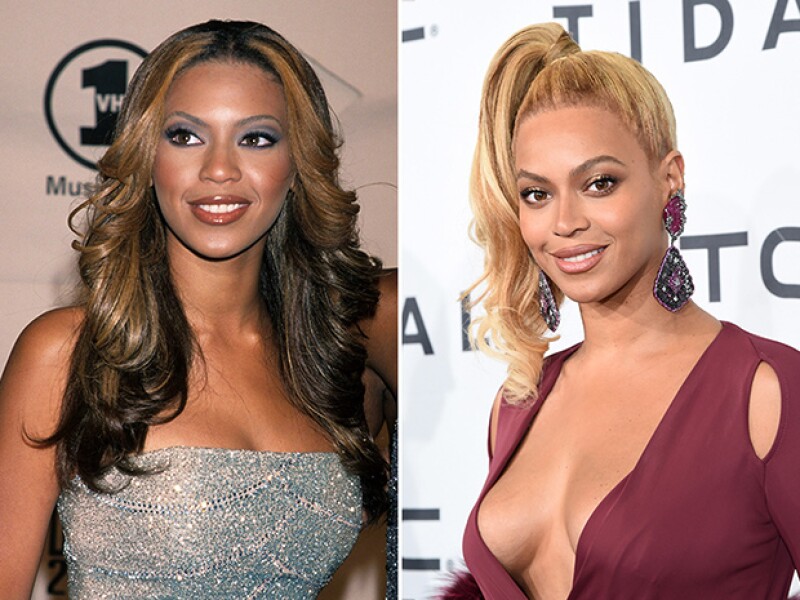 Beyoncé también ha sido señalada por blanquearse la piel.