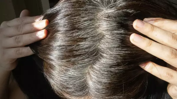 canas-en-ninos-es-normal