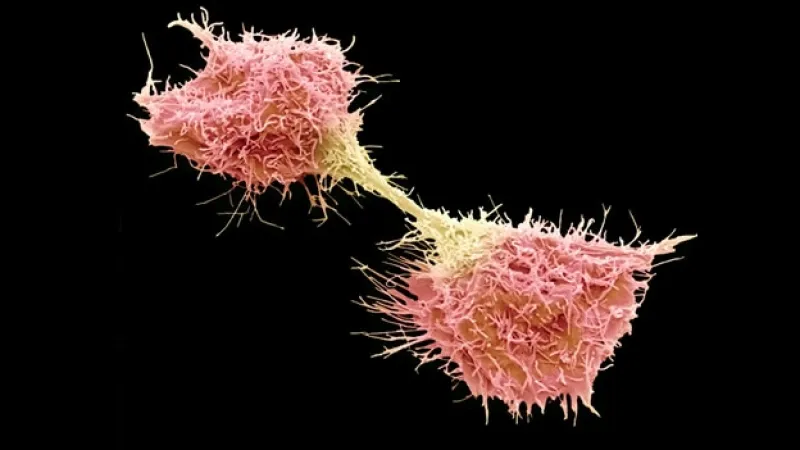 célula cancerígena
