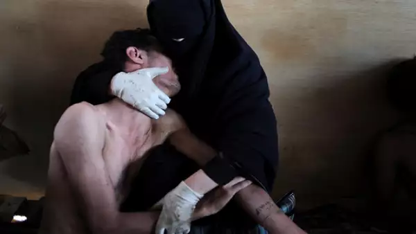 La imagen muestra a una mujer abrazando a un familiar herido, después de las protestas en contra del presidente Saleh en Sanaa, Yemen, el 15 de octubre de 2011.