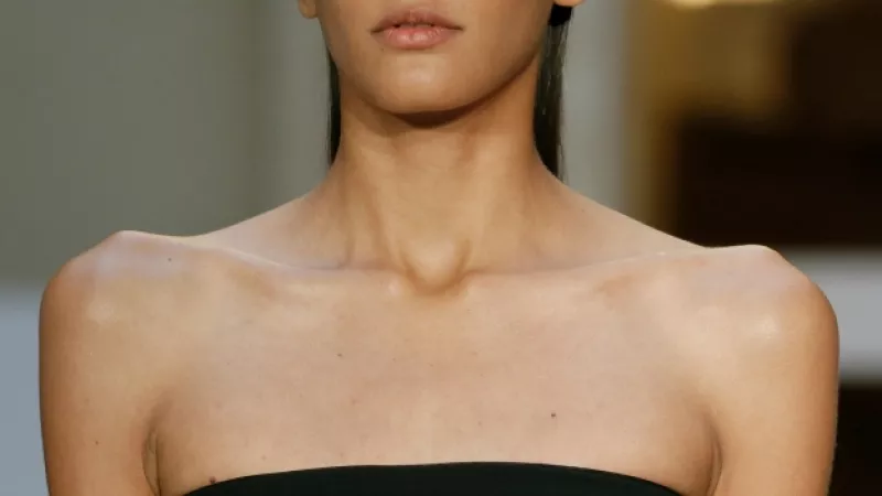 modelo anorexia francia