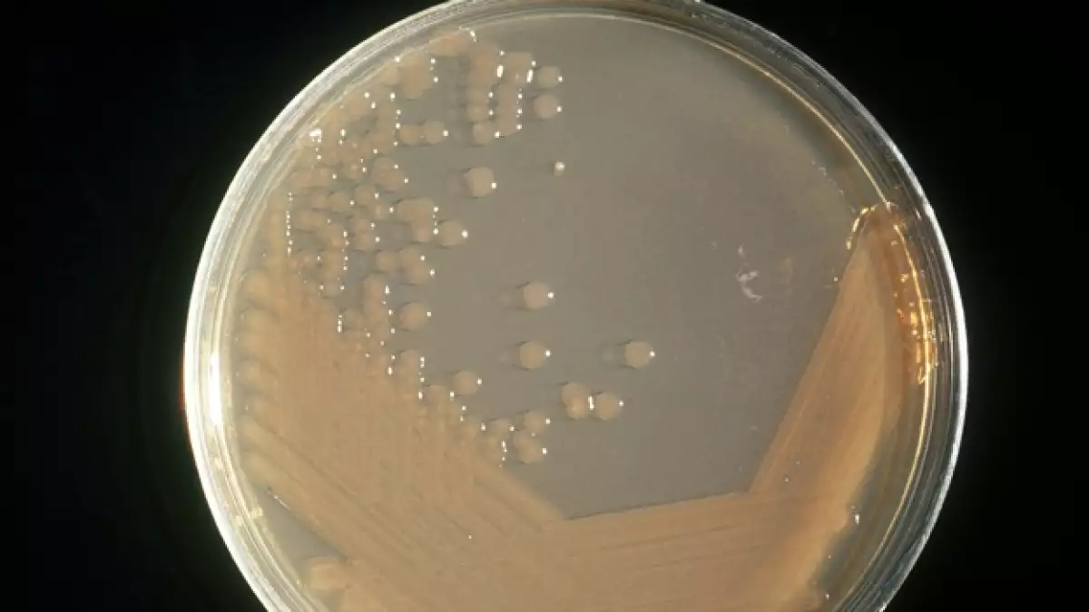 bacteria cólera