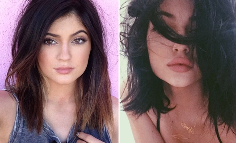 Los labios de Kylie hace diez meses y ahora, ¿efectos de maquillaje?