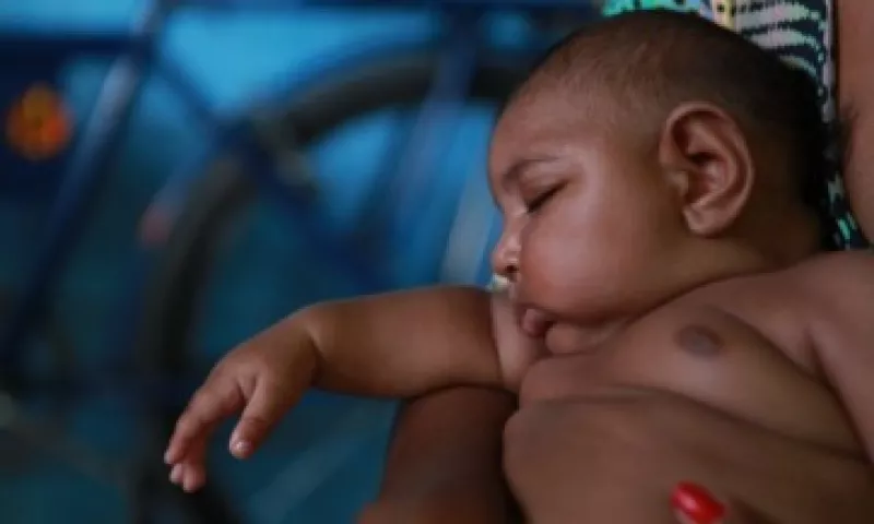 Luiz Felipe es uno de los más de 4,000 bebés que nacieron con microcefalia en Brasil desde octubre pasado (Foto: Miguel Castro/CNN)