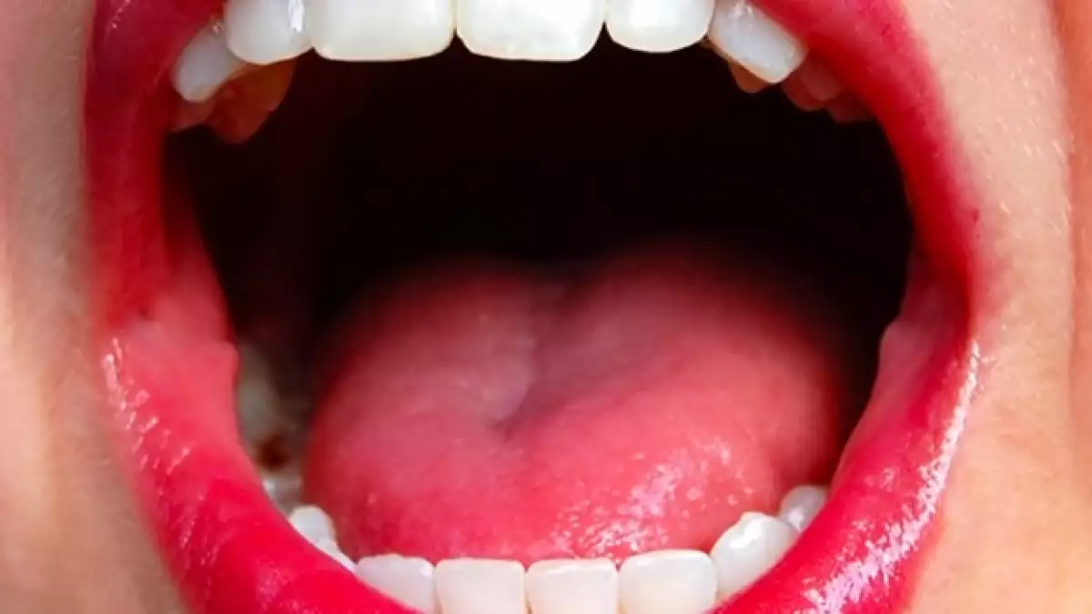 lengua