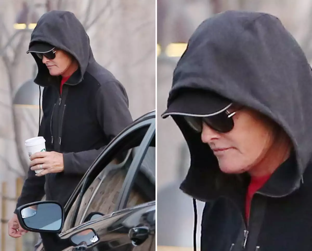 Los paparazzi captaron al polémico ex esposo de Kris Jenner en Los Ángeles esta mañana, y un zoom pudo hacer notar una gran cicatriz en los límites de su cara. ¿Se habrá operado?