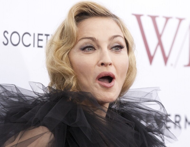 Madonna compartió con todos sus seguidores, los sacrificios que realiza para ofrecer espectáculos de calidad.