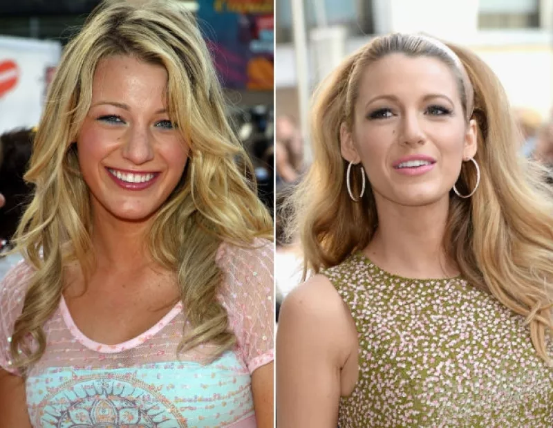 Tras el shock que provocó la nueva imagen de Renée Zellweger, recordamos a otras famosas que han pasado por el quirófano, logrando todo tipo de reacciones con sus cambios.