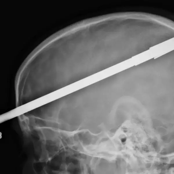 diaparo, lanza, sobrevive