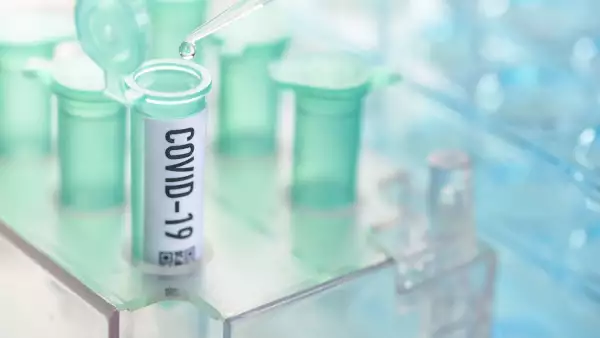 Corona virus: vial with pipette in laboratory