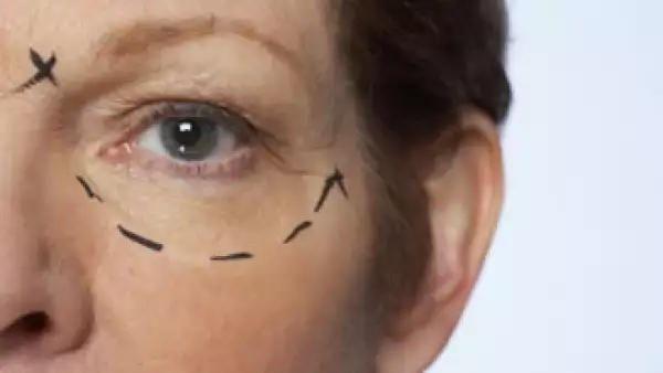 Las mujeres son quienes más se arriesgan con estos métodos practicados por charlatanes. (Foto: Jupiter Images)