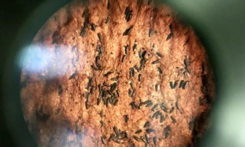 Huevos del mosquito Aedes aegypti, vistos a través de un microscopio (Foto: Miguel Castro/CNN)