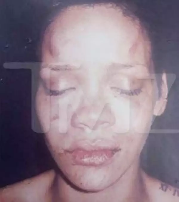 La imagen muestra golpes en la frente, sobre las cejas, y alrededor de los labios, así como inflamación general.