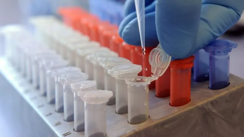 E. coli en Estados Unidos