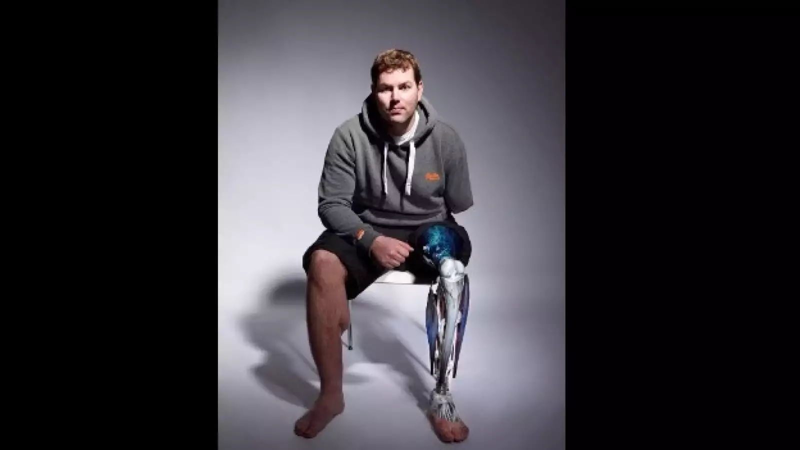 alternative-limb-project-09